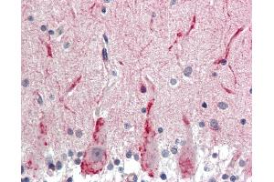 Anti-GABRG2 antibody IHC staining of human brain, cerebellum. (GABRG2 Antikörper  (AA 61-110))