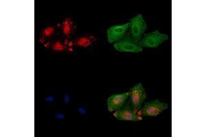 ABIN6262343 and ABIN6279489 staining  cells by IF/ICC.
