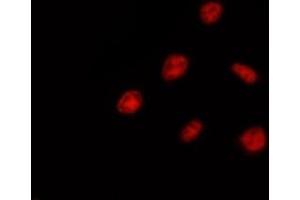 ABIN6275398 staining Hela by IF/ICC. (DDX52 Antikörper  (C-Term))