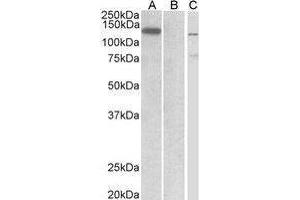 Western Blotting (WB) image for anti-Mindbomb E3 Ubiquitin Protein Ligase 1 (MIB1) (Internal Region) antibody (ABIN2475692) (MIB1 Antikörper  (Internal Region))