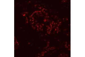 IF analysis of HnRNP H/HNRNPH1 using anti-HnRNP H/HNRNPH1 antibody (ABIN4886623).