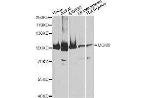 Western blot analysis of extracts of various cell lines, using MCM5 antibody (ABIN5973237) at 1:3000 dilution. (MCM5 Antikörper)