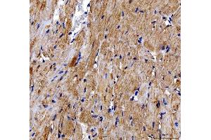 IHC analysis of DOK7 using anti-DOK7 antibody (ABIN6719428). (DOK7 Antikörper)