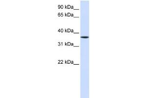 WB Suggested Anti-LHX8 Antibody Titration:  0. (LHX8 Antikörper  (Middle Region))