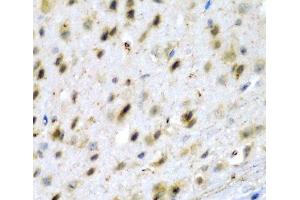 Immunohistochemistry of paraffin-embedded Mouse brain using TPH2 Polyclonal Antibody at dilution of 1:200 (40x lens). (Tryptophan Hydroxylase 2 Antikörper)