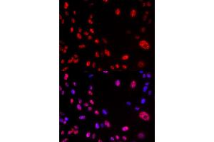 Immunofluorescence analysis of U2OS cells using Phospho-ATM-S1981 antibody (ABIN5969871).