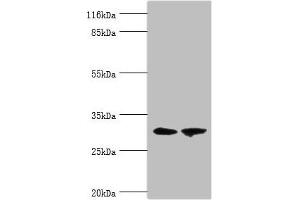 Western blot All lanes: ACBD4 antibody at 2 μg/mL Lane 1: Mouse kidney tissue Lane 2: Mouse liver tissue Secondary Goat polyclonal to rabbit IgG at 1/10000 dilution Predicted band size: 31, 35, 38 kDa Observed band size: 31 kDa (ACBD4 Antikörper  (AA 1-305))