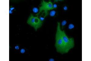 Immunofluorescence (IF) image for anti-Myotubularin Related Protein 14 (MTMR14) antibody (ABIN1499587)