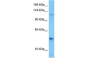 Host:  Mouse  Target Name:  HDAC6  Sample Tissue:  Mouse Spleen  Antibody Dilution:  1ug/ml (HDAC6 Antikörper  (C-Term))