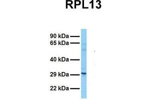 Host:  Rabbit  Target Name:  RPL13  Sample Tissue:  Human Fetal Lung  Antibody Dilution:  1.