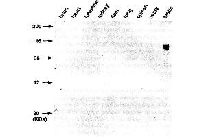 Western Blotting (WB) image for anti-Gena antibody (ABIN3201020) (Gena Antikörper)