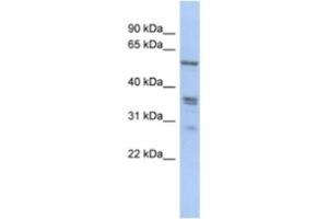 Western Blotting (WB) image for anti-Solute Carrier Family 38, Member 2 (SLC38A2) antibody (ABIN2463893) (SLC38A2 Antikörper)