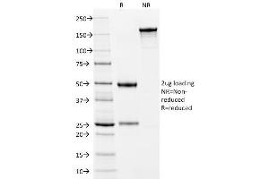 SDS-PAGE Analysis Purified Cytokeratin 10 Mouse Monoclonal Antibody (LH2). (Keratin 10 Antikörper)