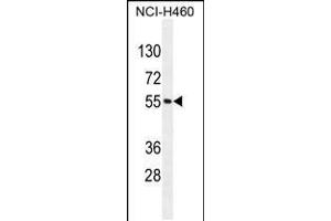 Western blot analysis in NCI-H460 cell line lysates (35ug/lane). (MIER2 Antikörper  (N-Term))