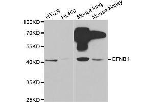 Western blot analysis of extracts of various cell lines, using EFNB1 antibody (ABIN5971350) at 1/1000 dilution. (Ephrin B1 Antikörper)