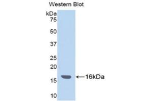 Western Blotting (WB) image for anti-Inter alpha Globulin Inhibitor H4 (ITIH4) (AA 29-157) antibody (ABIN1176673)