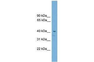 Mouse Muscle; WB Suggested Anti-Acd Antibody Titration: 0. (ACD Antikörper  (C-Term))