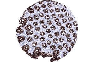 Immunohistochemistry (IHC) image for anti-LI Cadherin (AA 242-418) antibody (ABIN7477381)