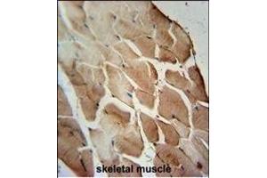 ACOT11 Antibody (C-term) (ABIN654089 and ABIN2843976) immunohistochemistry analysis in formalin fixed and paraffin embedded human skeletal muscle followed by peroxidase conjugation of the secondary antibody and DAB staining. (ACOT11 Antikörper  (C-Term))