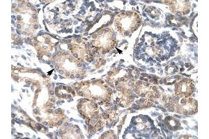 RGS20 antibody was used for immunohistochemistry at a concentration of 4-8 ug/ml to stain Epithelial cells of renal tubule (arrows) in Human Kidney. (RGS20 Antikörper  (Middle Region))