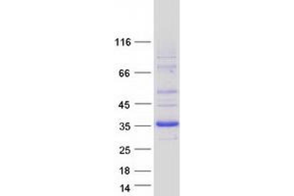 DHRS9 Protein (Transcript Variant 3) (Myc-DYKDDDDK Tag)