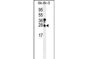 Western blot analysis of CHMP4B Antibody in SK-BR-3 cell line lysates (35ug/lane) (CHMP4B Antikörper  (N-Term))