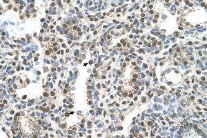 Image no. 1 for anti-Melanoma Antigen Family A, 8 (MAGEA8) (AA 51-100) antibody (ABIN6736631) (MAGEA8 Antikörper  (AA 51-100))