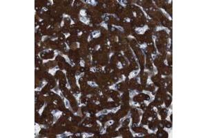 Immunohistochemical staining of human liver with CYP2C19 polyclonal antibody  shows strong cytoplasmic positivity in hepatocytes. (CYP2C9 Antikörper)