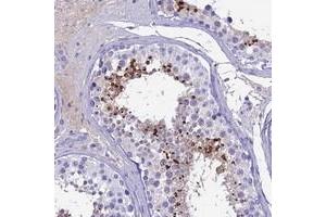 Immunohistochemical staining of human testis with SPACA4 polyclonal antibody  shows strong cytoplasmic positivity in spermatids. (SPACA4 Antikörper)