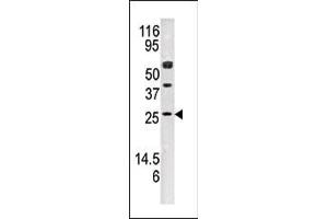 Western blot analysis of anti-AK3 Pab (ABIN392737 and ABIN2842197) in mouse kidney tissue lysate (35 μg/lane). (Adenylate Kinase 3 Antikörper  (N-Term))