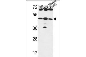 B3GNT5 Antibody (Center) (ABIN653601 and ABIN2842966) western blot analysis in 293,MDA-M,HL-60 cell line lysates (35 μg/lane). (B3GNT5 Antikörper  (AA 118-145))