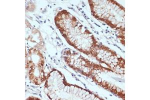 Immunohistochemistry of paraffin-embedded human stomach using CXCL12 antibody (ABIN6130152, ABIN6139271, ABIN6139272 and ABIN6217180) at dilution of 1:100 (40x lens). (CXCL12 Antikörper  (AA 22-89))