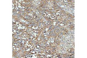 IHC analysis of ICAM1 using anti-ICAM1 antibody (ABIN5692991). (ICAM1 Antikörper  (AA 28-268))