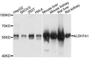 Western blot analysis of extracts of various cell lines, using ALDH7A1 antibody. (ALDH7A1 Antikörper  (AA 430-539))
