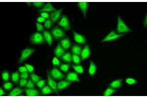 Immunofluorescence analysis of U2OS cells using RNF40 Polyclonal Antibody (RNF40 Antikörper)