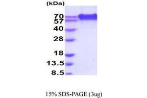 CD320 Protein (AA 31-229) (hIgG-His-tag)