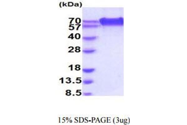 CD320 Protein (AA 31-229) (hIgG-His-tag)