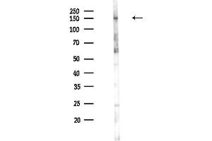 Western blot analysis of lysates from Rat brain, using Niemann Pick C1 Antibody at 1/1000 dilution.