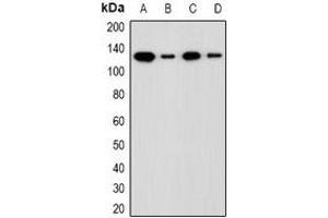 Western blot analysis of ADNP expression in LOVO (A), HCT116 (B), mouse liver (C), rat liver (D) whole cell lysates. (ADNP Antikörper  (N-Term))