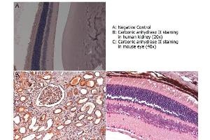 Immunohistochemistry with anti-carbonic anhydrase II antibody showing carbonic anhydrase II staining in nucleus and cytoplasm of proximal and distal tubules, bowman’s capsule and glomerular podocytes of human kidney (B) and in basal cells of retina of a mouse eye (C). (CA2 Antikörper)