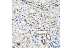 Immunohistochemistry of paraffin-embedded rat kidney using HSD11B2 antibody (ABIN5995471) at dilution of 1/100 (40x lens). (HSD11B2 Antikörper)