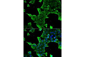Immunofluorescence analysis of A549 cells using NCS1 antibody. (NCS1 Antikörper)