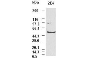 CK8 antibody (2E4) at 1:1000 dilution + Hela cell lysate (KRT8 Antikörper  (AA 91-381))