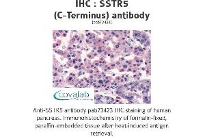 Image no. 1 for anti-Somatostatin Receptor 5 (SSTR5) (C-Term) antibody (ABIN1739676) (SSTR5 Antikörper  (C-Term))