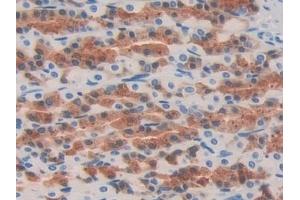 Immunohistochemistry (IHC) image for anti-Oncoprotein Induced Transcript 3 (OIT3) (AA 251-524) antibody (ABIN7443347)