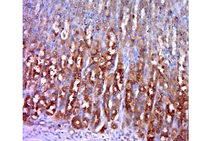 Paraformaldehyde-fixed, paraffin embedded rat stomach, Antigen retrieval by boiling in sodium citrate buffer (pH6. (Hexokinase 1 Antikörper  (AA 501-600))