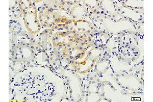 Formalin-fixed and paraffin embedded: rat kidney tissue labeled with Anti-PKCB Polyclonal Antibody, Unconjugated (ABIN727010) at 1:200, followed by conjugation to the secondary antibody and DAB staining