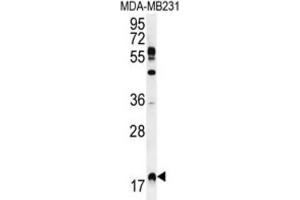 Western Blotting (WB) image for anti-Ras Homolog Enriched in Brain (RHEB) antibody (ABIN2996362) (RHEB Antikörper)
