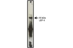 Western Blotting (WB) image for anti-Lymphoid Enhancer-Binding Factor 1 (LEF1) antibody (ABIN953159) (LEF1 Antikörper)