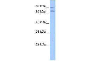Junctophilin 2 antibody used at 1 ug/ml to detect target protein. (Junctophilin 2 Antikörper  (Middle Region))